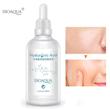 سرم پوست بیوآکوا مدل Hyaluronic asid حجم100میلی لیتر