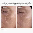 تونر لایه بردار گلیکولیک اسید ۷ درصد برای صاف و روشن شدن پوست