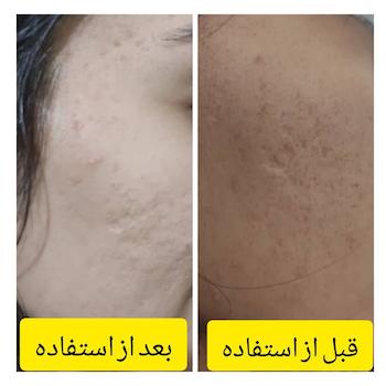 کرم ضد لک و روشن کننده گیاهی سی دام | آبرسان قوی پوست‌ های خشک، فاقد کورتون