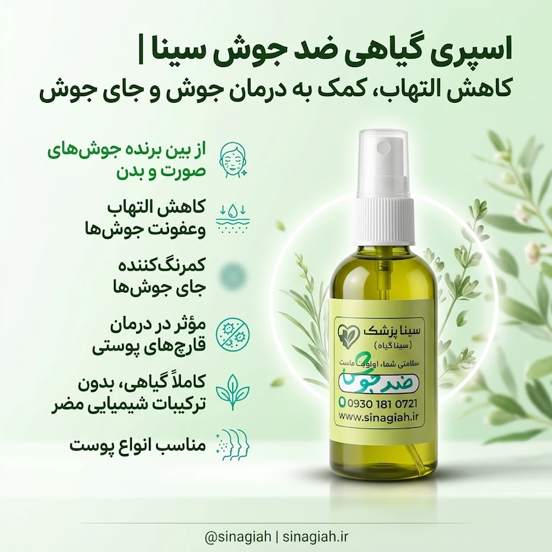 اسپری گیاهی ضد جوش سینا | رفع جوش و جای جوش صورت و بدن