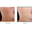آمپول گلوتاتیون مکس کلینیک Maxclinic Glutathione Ampoule Shot