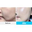 کرم پاور آکوا مدی‌پیل Medi Peel Power Aqua Cream