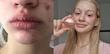 ماسک لب ژلی کلاژن و PDRN ابیب | Abib PDRN Collagen Lip Mask Glazed Jelly