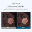 کرم ضد لک و روشن کننده ترانگزامیک اسید دکتر ملاکسین | Dr.Melaxin TX Tranexamic Acid CREAM