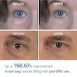کرم دور چشم ضد چروک و رفع پف دکتر ملاکسین مدل Eyephalt