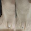 کرم لیفتینگ و ضد چروک گردن مدی پیل | Medi-Peel premium collagen naite thread neck cream 2.0