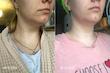 کرم لیفتینگ و ضد چروک گردن مدی پیل | Medi-Peel premium collagen naite thread neck cream 2.0