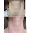 کرم لیفتینگ و ضد چروک گردن مدی پیل | Medi-Peel premium collagen naite thread neck cream 2.0