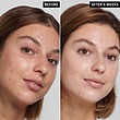  شوینده سالیسیلیک اسید اینکی لیست