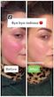 کرم درمان و اصلاح رنگ پوست دکتر جارت | Dr.Jart+ Cicapair Tiger Grass Color Correcting Treatment