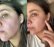 کرم درمان و اصلاح رنگ پوست دکتر جارت | Dr.Jart+ Cicapair Tiger Grass Color Correcting Treatment