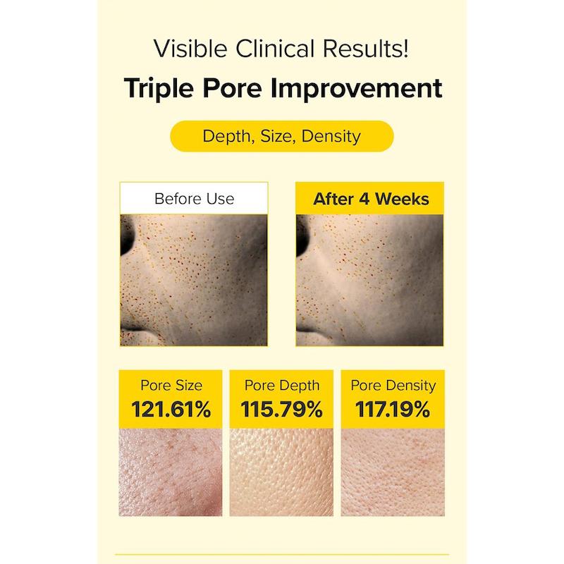 کرم اسپیکول رتینول و PDRN مری اند می ضد چروک و جوانساز پوست | Mary & May Spicule Retinol PDRN Cream
