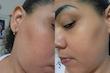 ژل تونر PDRN اکسیس وای آبرسان، ترمیم کننده و تسکین دهنده پوست | AXIS-Y Triple PDRN Gel Toner