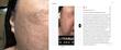 کرم جوانساز، ضدچروک و تسکین دهنده قوی سنتلیان 24 | Centellian24 Madeca Cream Time Reverse