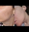 کرم جوانساز، ضدچروک و تسکین دهنده قوی سنتلیان 24 | Centellian24 Madeca Cream Time Reverse