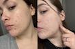 کرم جوانساز، ضدچروک و تسکین دهنده قوی سنتلیان 24 | Centellian24 Madeca Cream Time Reverse
