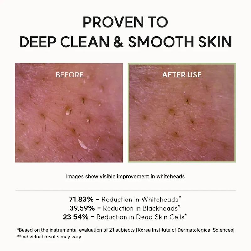 پاک کننده عمقی موچی برنج و چای سبز آرنسیا تسکین دهنده و کنترل چربی پوست | Arencia Fresh Green Rice Mochi Cleanser