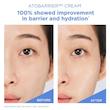 کرم ترمیم کننده و مرطوب کننده قوی اتو بریر 365 استرا | Aestura Atobarrier 365 Cream
