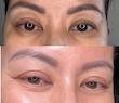کرم دور چشم دوگانه ترانگزامیک اسید و رتینال دکتر ملاکسین | Dr.Melaxin TX Retinalsome Double Effect Eye Cream