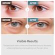 کرم دور چشم دوگانه ترانگزامیک اسید و رتینال دکتر ملاکسین | Dr.Melaxin TX Retinalsome Double Effect Eye Cream