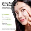 لوسیون مرطوب کننده آزلائیک اسید و سیکا آنوا | Anua Azelaic Acid Cica Skin Soothing Moisturizer