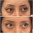 کرم دور چشم رتینول ۰.۱٪ و کافئین آنوا | Anua Retinol 0.1 Caffeine Revitalizing Eye Cream