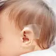 چسب اصلاح فرم گوش نوزاد