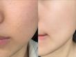  تونر پاک‌کننده و جمع‌کننده منافذ بی‌ د اسکین  Be The Skin BHA+ Pore Zero Toner