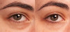 ژل کرم دور چشم گواوا گلو رسپی | Guava Gel Cream around the eyes all skin types glow recipe