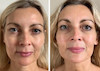 کنسانتره جوانساز اولتیمون شیسیدو اصل حجم10 میل