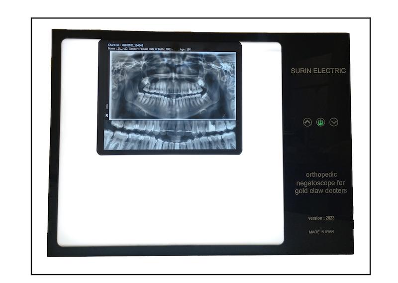 نگاتوسکوپ پزشکی ارتوپدی  بزرگ برند surinelctric