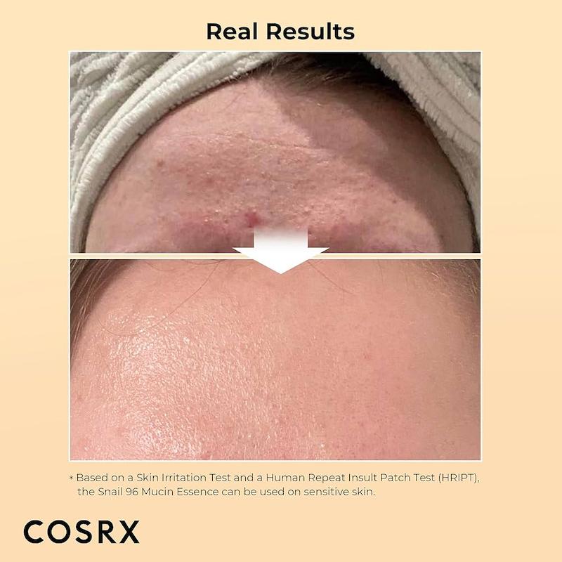 اسنس حلزون کوزارکس اورجینال  cosrx 