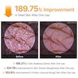  اسپری لایه بردار بدن دکتر ملاکسین مدل Peel Shot Kojic Acid