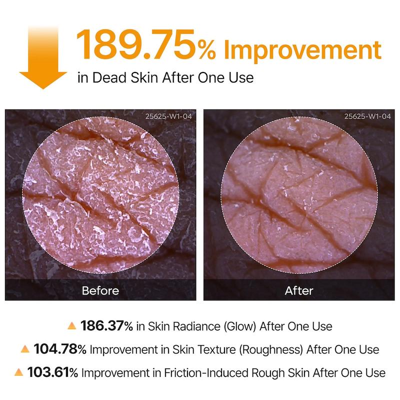  اسپری پیل شات بدن دکتر ملاکسین مدل Peel Shot Kojic Acid
