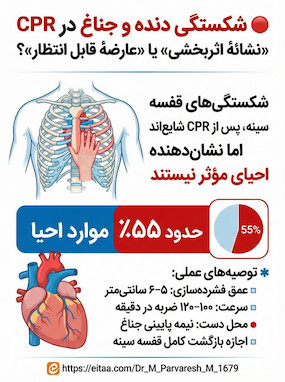 اینفوگرافی شکستگی دنده و جناغ در CPR  2025