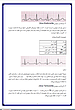 جزوه تفسیر نوار قلب , جزوه ecg , جزوه ekg