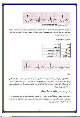 جزوه تفسیر نوار قلب , جزوه ecg , جزوه ekg