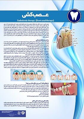 پوستر عصب کشی دندان, پوستر دندانپزشکی