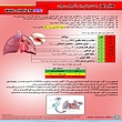 پوستر ارزیابی PTE بر اساس معیار ولز Wells Score  پوستر معیار ولز و ارزیابی میزان خطر آمبولی ریه