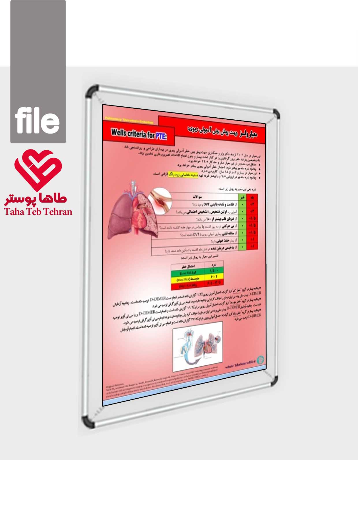پوستر ارزیابی PTE بر اساس معیار ولز Wells Score (پوستر معیار ولز و ارزیابی میزان خطر آمبولی ریه)