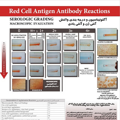 پوستر آگلوتیناسیون , درجه بندی واکنش آنتی ژن و آنتی بادی, هموویژولانس , agglutination