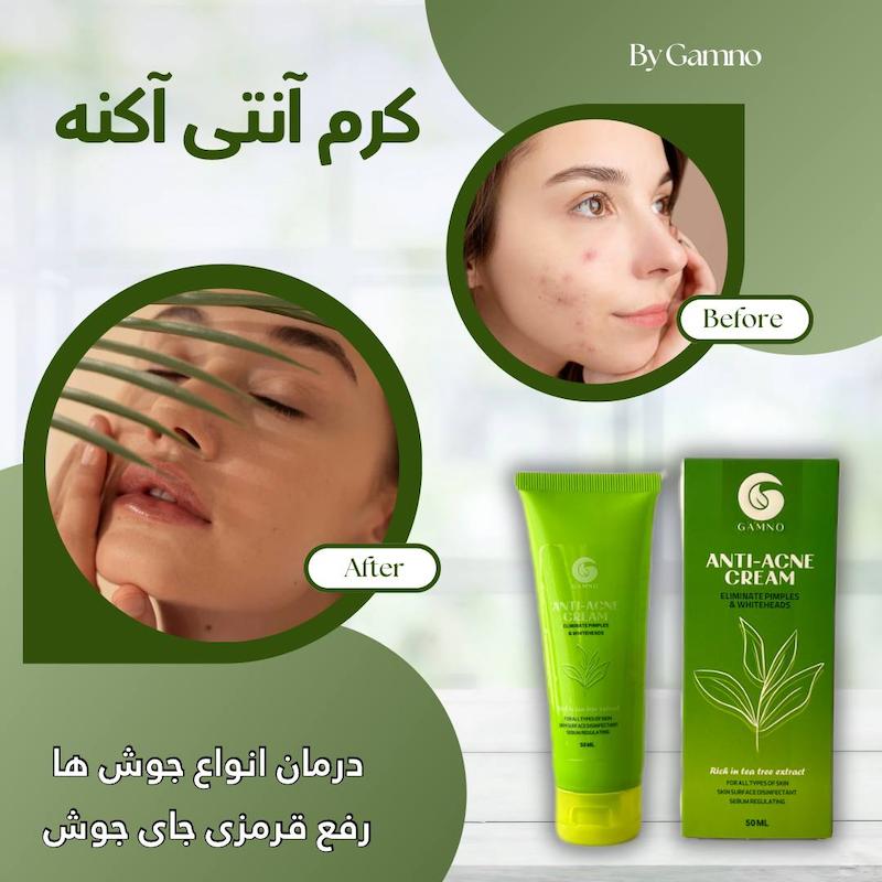 کرم آنتی آکنه (ضد جوش) گامنو