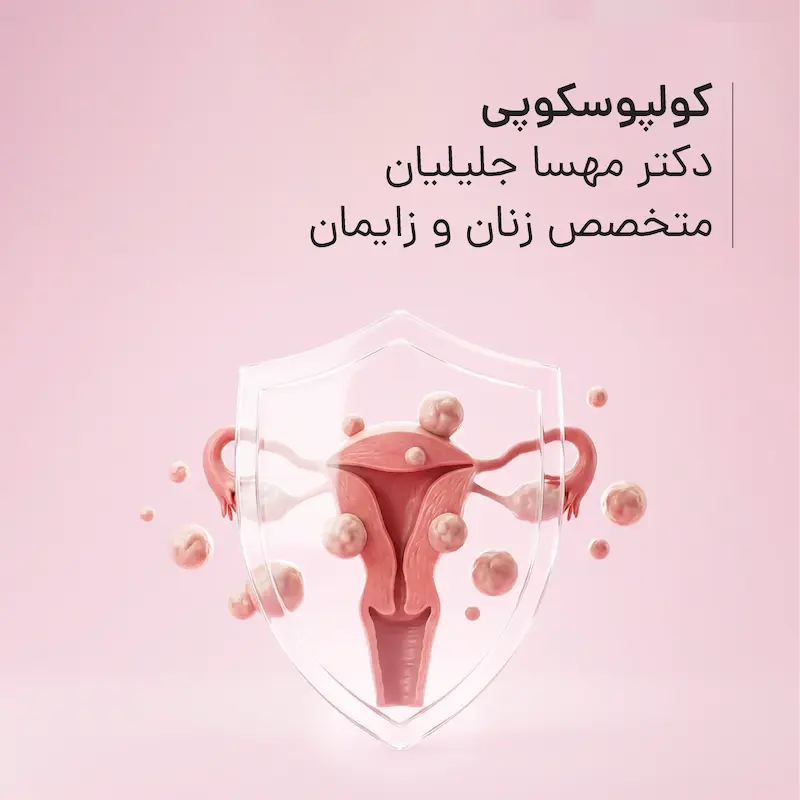 کولپوسکوپی مطب دکتر مهسا جلیلیان