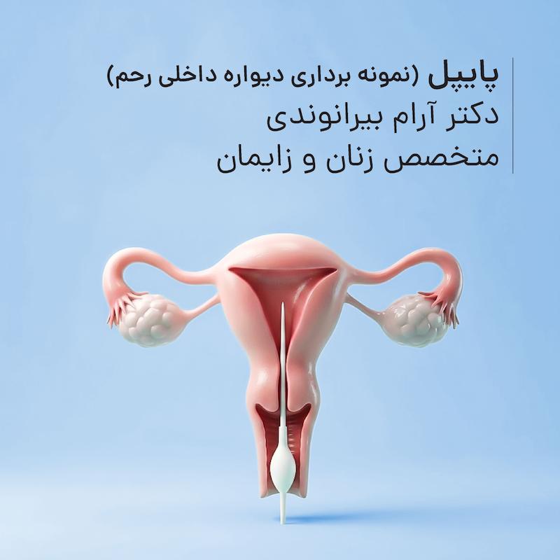 پایپل (نمونه برداری دیواره داخلی رحم) مطب دکتر آرام بیرانوندی