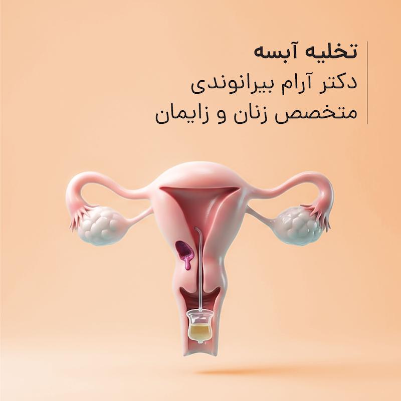 تخلیه آبسه مطب دکتر آرام بیرانوندی