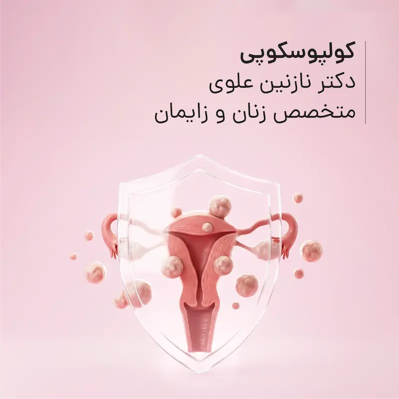 کولپوسکوپی مطب دکتر نازنین علوی