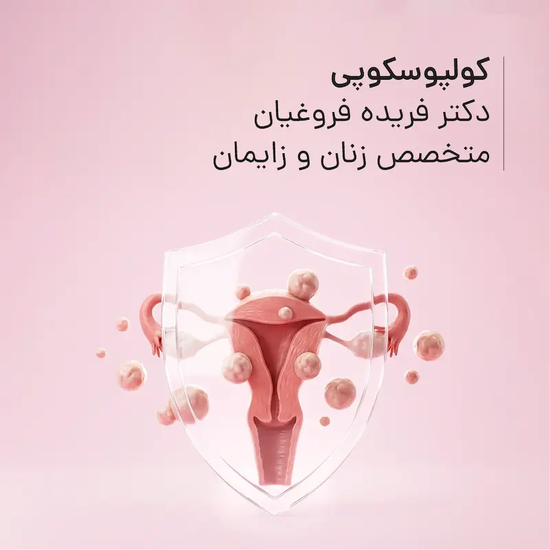 کولپوسکوپی مطب دکتر فریده فروغیان