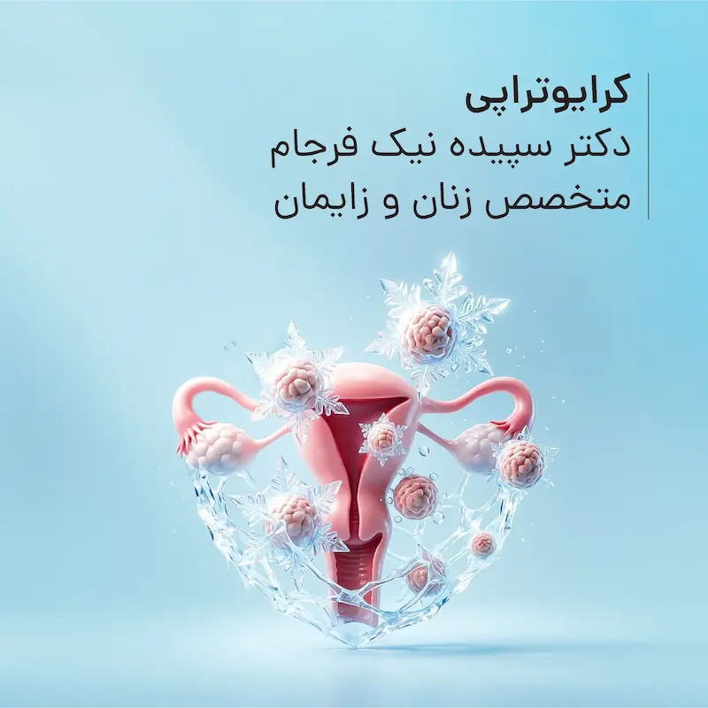 کرایوتراپی مطب دکتر سپیده نیک فرجام