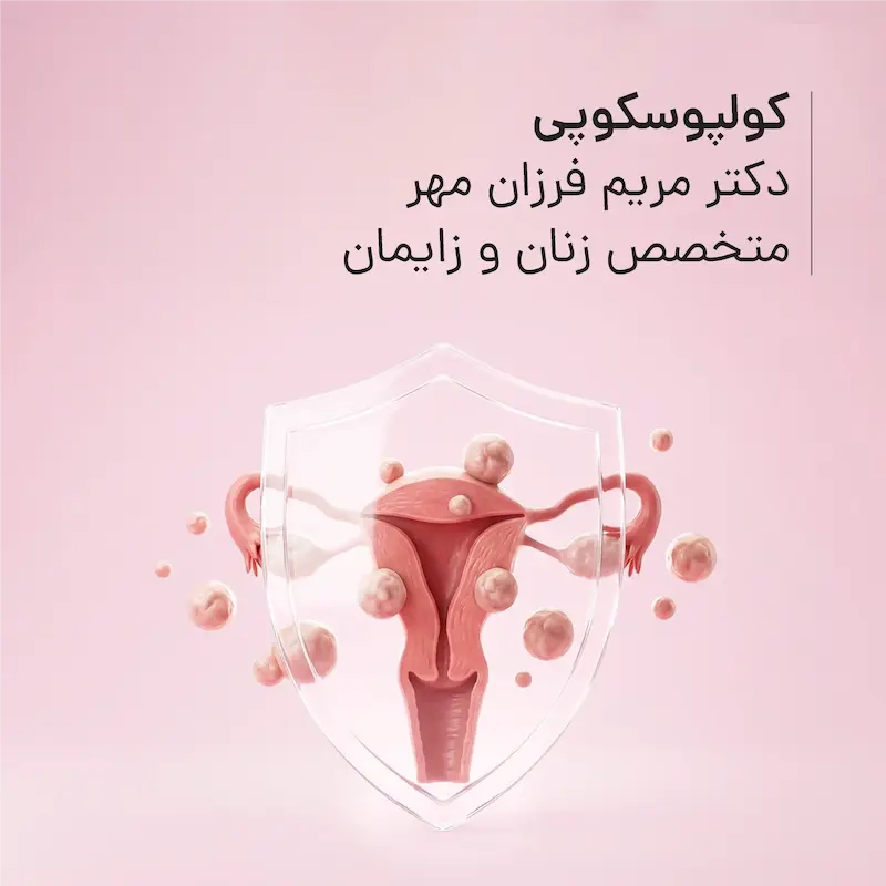 کولپوسکوپی مطب دکتر مریم فرزان‌مهر