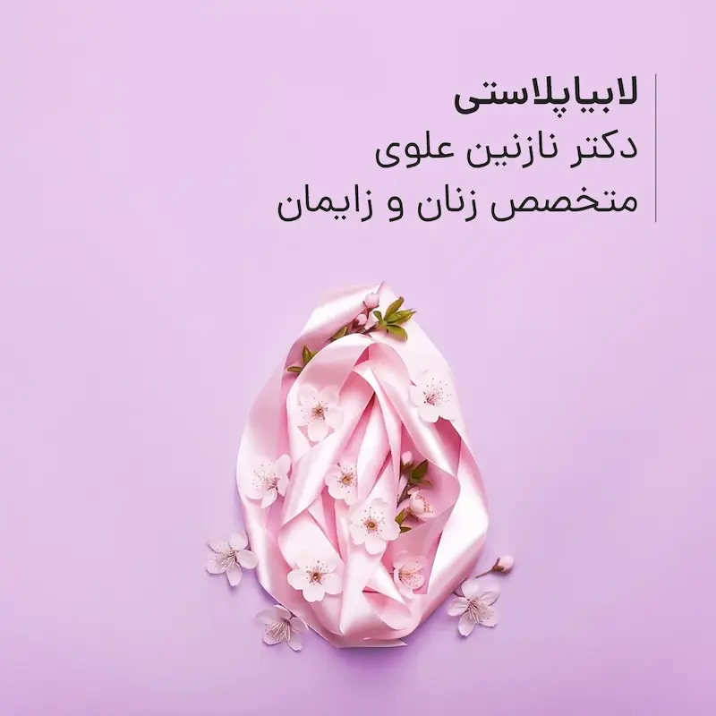 لابیاپلاستی مطب دکتر نازنین علوی